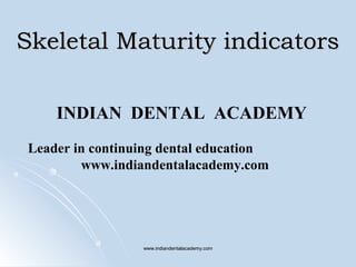 Skeletal Maturity indicators
INDIAN DENTAL ACADEMY
Leader in continuing dental education
www.indiandentalacademy.com

www.indiandentalacademy.com

 