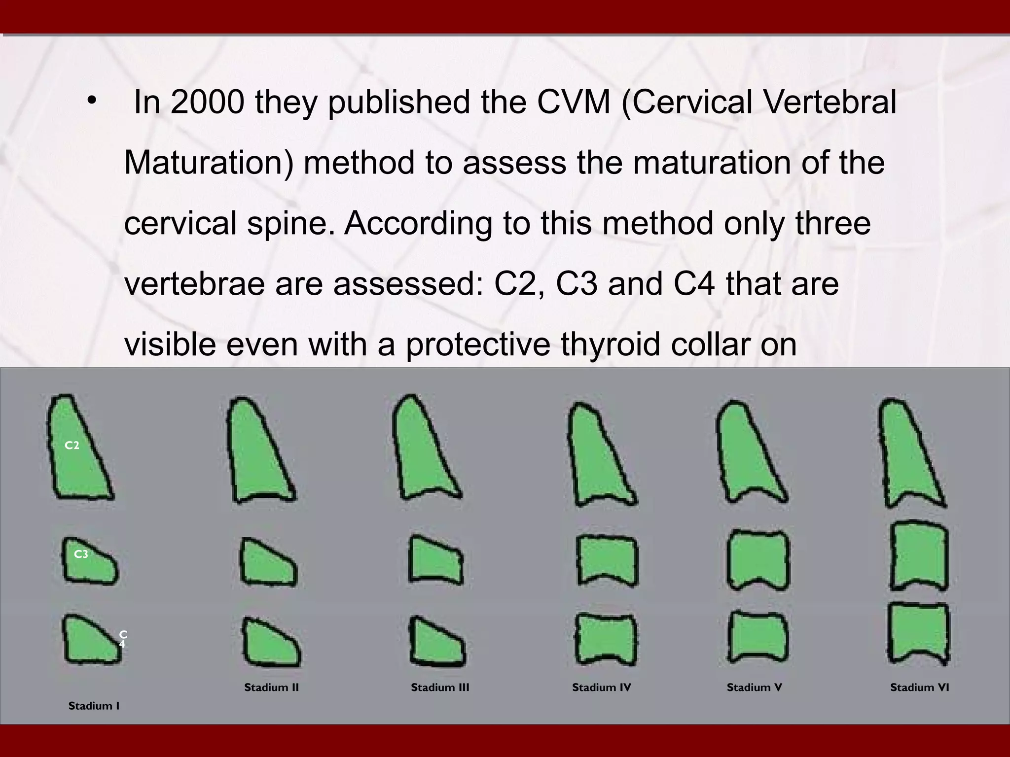 Skeletal maturity indicators | PPT