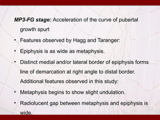 MP3-FG stage: Acceleration of the curve of pubertal
growth spurt
• Features observed by Hagg and Taranger:
• Epiphysis is as wide as metaphysis.
• Distinct medial and/or lateral border of epiphysis forms
line of demarcation at right angle to distal border.
Additional features observed in this study:
• Metaphysis begins to show slight undulation.
• Radiolucent gap between metaphysis and epiphysis is
wide.
 