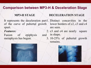 Comparison between MP3-H & Deceleration Stage
MP3-H STAGE DECELERATION STAGE
It represents the deceleration part
of the curve of pubertal growth
spurt.
Features:
Fusion of epiphysis and
metaphysis has begun.
1. Distinct concavities in the
lower borders of c2, c3 and c4
are seen.
2. c3 and c4 are nearly square
in shape.
3. 10-25% of pubertal growth
remains.
 