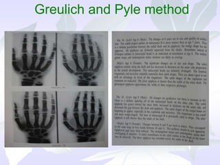 Greulich and Pyle method
 