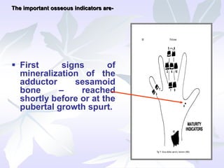  First signs of
mineralization of the
adductor sesamoid
bone – reached
shortly before or at the
pubertal growth spurt.
The important osseous indicators are-
 