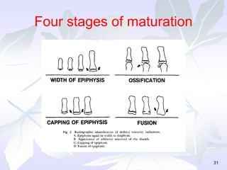 Four stages of maturation
31
 