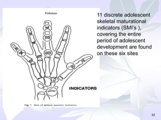32
11 discrete adolescent
skeletal maturational
indicators (SMI’s ),
covering the entire
period of adolescent
development are found
on these six sites
 