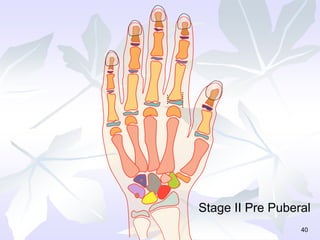 40
Stage II Pre Puberal
 
