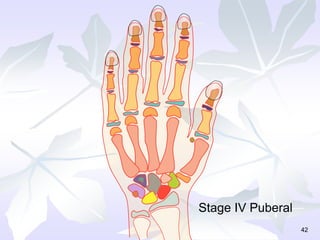 42
Stage IV Puberal
 