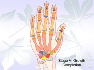 44
Stage VI Growth
Completion
 
