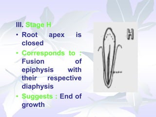 III. Stage H
• Root apex is
closed
• Corresponds to :
Fusion of
epiphysis with
their respective
diaphysis
• Suggests : End of
growth
 