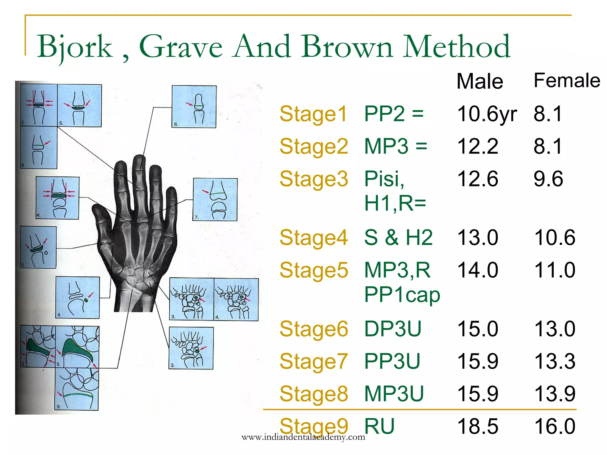 Bjork , Grave And Brown Method
Male Female
Stage1 PP2 = 10.6yr 8.1
Stage2 MP3 = 12.2 8.1
Stage3 Pisi,
H1,R=
12.6 9.6
Stage4 S & H2 13.0 10.6
Stage5 MP3,R
PP1cap
14.0 11.0
Stage6 DP3U 15.0 13.0
Stage7 PP3U 15.9 13.3
Stage8 MP3U 15.9 13.9
Stage9 RU 18.5 16.0www.indiandentalacademy.com
 