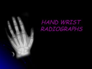 HAND WRIST
HAND WRIST
RADIOGRAPHS
RADIOGRAPHS
 