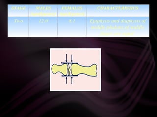 STAGE MALES
Aged(years)
FEMALES
Aged(years)
CHARACTERISTICS
Two 12.0 8.1 Epiphysis and diaphysis of
middle phalanx of middle
finger are equal
 