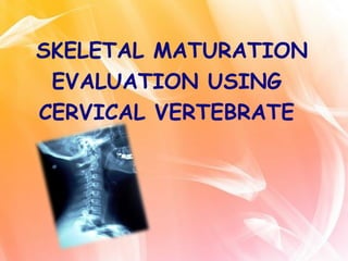 SKELETAL MATURATION
EVALUATION USING
CERVICAL VERTEBRATE
 