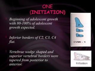 ONE
(INITIATION)
 Beginning of adolescent growth
with 80-100% of adolescent
growth expected.
 Inferior borders of C2, C3, C4
flat.
 Vertebrae wedge shaped and
superior vertebral borders were
tapered from posterior to
anterior.
 