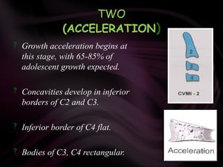 TWO
(ACCELERATION)
 Growth acceleration begins at
this stage, with 65-85% of
adolescent growth expected.
 Concavities develop in inferior
borders of C2 and C3.
 Inferior border of C4 flat.
 Bodies of C3, C4 rectangular.
 