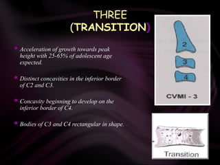 THREE
(TRANSITION)
 Acceleration of growth towards peak
height with 25-65% of adolescent age
expected.
 Distinct concavities in the inferior border
of C2 and C3.
 Concavity beginning to develop on the
inferior border of C4.
 Bodies of C3 and C4 rectangular in shape.
 