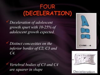 FOUR
(DECELERATION)
 Deceleration of adolescent
growth spurt with 10-25% of
adolescent growth expected.
 Distinct concavities on the
inferior border of C2, C3 and
C4.
 Vertebral bodies of C3 and C4
are squarer in shape
 
