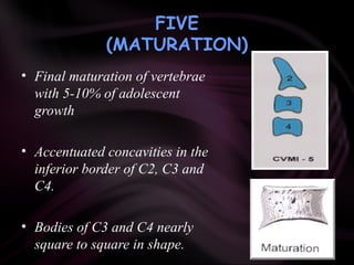FIVE
(MATURATION)
• Final maturation of vertebrae
with 5-10% of adolescent
growth
• Accentuated concavities in the
inferior border of C2, C3 and
C4.
• Bodies of C3 and C4 nearly
square to square in shape.
 