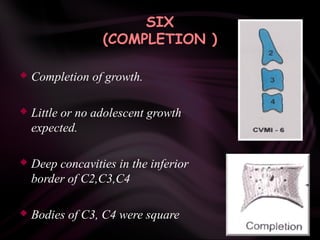 SIX
(COMPLETION )
 Completion of growth.
 Little or no adolescent growth
expected.
 Deep concavities in the inferior
border of C2,C3,C4
 Bodies of C3, C4 were square
 