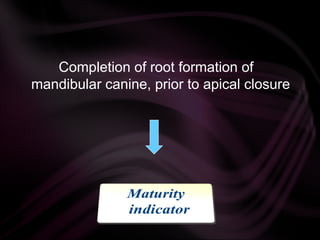 Completion of root formation of
mandibular canine, prior to apical closure
 