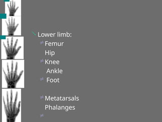 





Lower limb:
Femur
Hip
Knee
Ankle
Foot
Metatarsals
Phalanges
 