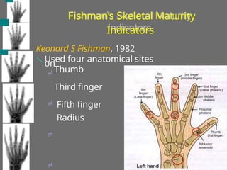 Fishman’s Skeletal Maturity
Indicators
Keonord S Fishman, 1982
 Used four anatomical sites
on




Thumb
Third finger
Fifth finger
Radius
 