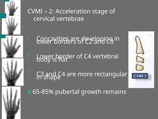CVMI – 2: Acceleration stage of
cervical vertebrae
1. Concavities are developing in
lower borders of C2 and C3
Lower border of C4 vertebral
body is flat
C3 and C4 are more rectangular
in shape
2.
3.
4.65-85% pubertal growth remains
 