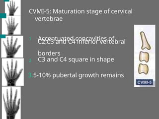 CVMI-5: Maturation stage of cervical
vertebrae
1 Accentuated concavities of
C2,C3 and C4 inferior vertebral
borders
C3 and C4 square in shape
2
3.5-10% pubertal growth remains
 