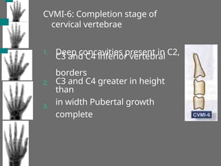 CVMI-6: Completion stage of
cervical vertebrae
1. Deep concavities present in C2,
C3 and C4 inferior vertebral
borders
C3 and C4 greater in height
than
in width Pubertal growth
complete
2.
3.
 