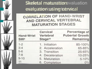 Skeletal maturation
evaluation using cervical
vertebrae
 