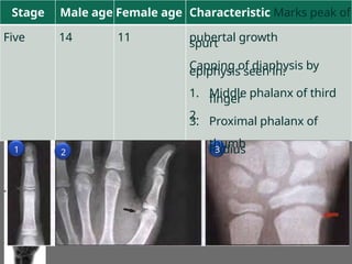 Stage Male age Female age Characteristic Marks peak of
pubertal growth
spurt
Capping of diaphysis by
epiphysis seen in:
Five 14 11
1.
2.
3.
Middle phalanx of third
finger
Proximal phalanx of
thumb
Radius
1 2 3
 