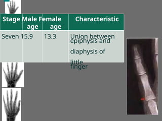 Stage Male Female Characteristic
age age
Seven 15.9 13.3 Union between
epiphysis and
diaphysis of
little
finger
 