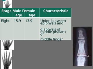 Stage Male Female Characteristic
age age
Eight 15.9 13.9 Union between
epiphysis and
diaphysis of
middle phalanx
of
middle finger
 