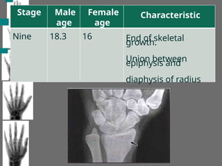 Stage Male
age
Nine 18.3
Female
age
16
Characteristic
End of skeletal
growth.
Union between
epiphysis and
diaphysis of radius
 