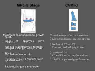 Maximum point of pubertal growth
spurt.
Sides of epiphysis have
thickened
and cap its metaphysis, forming
sharp distal edge on one or both
sides.
Marked undulations in
metaphysis give it “Cupid’s bow’’
appearance.
Radiolucent gap is moderate.



Transition stage of cervical vertebrae
 Distinct concavities are seen in lower
borders of C2 and C3.

Concavity is developing in lower
border of C4.

C3 and C4 are rectangular in shape.
 25-65% of pubertal growth remains.
 