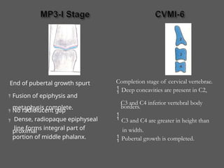 End of pubertal growth spurt
 Fusion of epiphysis and
metaphysis complete.
No radiolucent gap
Dense, radiopaque epiphyseal
line forms integral part of
proximal
portion of middle phalanx.



in width.
Pubertal growth is completed.
Completion stage of cervical vertebrae.
 Deep concavities are present in C2,
C3 and C4 inferior vertebral body
borders.
 C3 and C4 are greater in height than
 