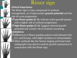 Risser sign
Clinical Importance:
The Risser sign is a key component in scoliosis
management, as it helps predict growth potential and the
risk of curve progression.
 Low Risser grades (0–2): Indicate active growth phases
with a higher risk of scoliosis progression.
 High Risser grades (3–5): Suggest reduced growth
potential and a lower risk of scoliosis worsening.
Limitations:
 Differences in Risser grading systems exist between the
U.S. and Europe, with slight variations in interpretation.
 Other methods like the Tanner staging and hand-wrist
radiographs may also be used for growth assessment in
conjunction with the Risser sign.
 