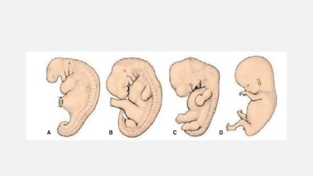 skeletal muscle development of fetus embryonic growth | PPTX