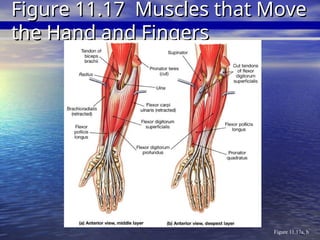 Figure 11.17a, b
Figure 11.17 Muscles that Move
Figure 11.17 Muscles that Move
the Hand and Fingers
the Hand and Fingers
 