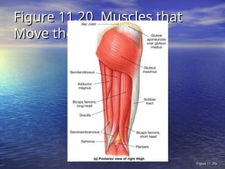Figure 11.20 Muscles that
Figure 11.20 Muscles that
Move the Leg
Move the Leg
Figure 11.20a
 