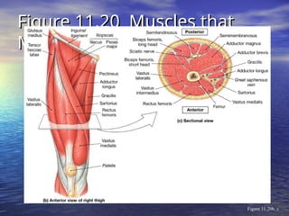 Figure 11.20 Muscles that
Figure 11.20 Muscles that
Move the Leg
Move the Leg
Figure 11.20b, c
 