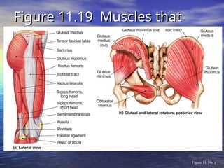 Figure 11.19 Muscles that
Figure 11.19 Muscles that
Move the Thigh
Move the Thigh
Figure 11.19a, c
 