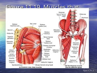 Figure 11.19 Muscles that
Figure 11.19 Muscles that
Move the Thigh
Move the Thigh
Figure 11.19c, d
 