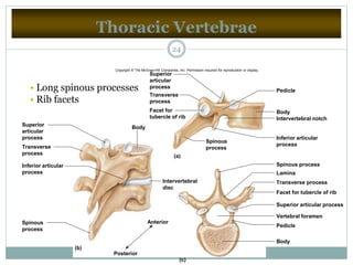 Thoracic Vertebrae
24
BodySuperior
articular
process
Spinous
process
Transverse
process
Inferior articular
process
Intervertebral
disc
Anterior
Posterior
Body
Pedicle
Vertebral foramen
Superior articular process
Facet for tubercle of rib
Transverse process
Lamina
Spinous process
Inferior articular
process
Intervertebral notch
Body
Pedicle
Superior
articular
process
Transverse
process
Facet for
tubercle of rib
Spinous
process
(a)
(c)
(b)
• Long spinous processes
• Rib facets
Copyright © The McGraw-Hill Companies, Inc. Permission required for reproduction or display.
 