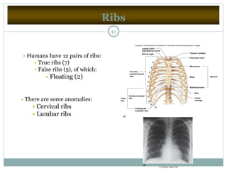 Ribs
30
• Humans have 12 pairs of ribs:
• True ribs (7)
• False ribs (5), of which:
• Floating (2)
• There are some anomalies:
• Cervical ribs
• Lumbar ribs
1
2
3
4
5
6
7
8
9
10
11
12
True ribs
(vertebrosternal
ribs)
Vertebrochondral
ribsFalse
ribs
(a)
Floating ribs
(vertebral ribs)
SternumBody
Manubrium
Ribs
Costal
cartilage
Xiphoid process
Thoracic vertebra
Clavicular notch
Sternal angle
Jugular notch
(suprasternal notch)
(b)
b: © Victor B. Eichler, PhD
Copyright © The McGraw-Hill Companies, Inc. Permission required for reproduction or display.
 