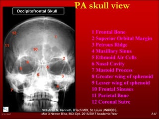Petrous Ridge Positioning Chart Comprehensive Skeletal Radiographic Anatomy, MDIRT, Nchanji Nkeh Keneth ...