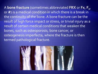 PreventionCalcium is essential for building and maintaining healthy bone. Vitamin D is also needed because it helps your body absorb calciumFollow a diet that provides the proper amount of calcium, vitamin D, and proteinQuit smoking. Limit alcohol intakeIt is also critical to prevent falls