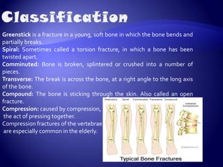 DiagnosisA densitometry or DEXA scan can measure how much bone you haveQuantitative computed tomography (QCT) may be used in rare cases.A spine or hip x-ray may show fracture or collapse of the spinal bones. However, simple x-rays of bones are not very accurate in predicting whether someone is likely to have osteoporosis.