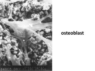 osteoblast
 