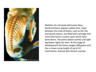 Skeleton of a 16 week old human fetus.
Hardened bone appears yellow here. Gaps
between the ends of bones, such as the ribs
and spinal column, are filled with cartilage (not
seen) that forms a matrix upon which hard
bone forms. The pelvis (lower centre) and right
leg (lower right) are seen. At this stage of
development the foetus weighs 200 grams and
has a crown-rump length of up to 14
centimetres. Stained with Alizarin red dye.
 