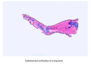 Endochondral ossification of a long bone
 